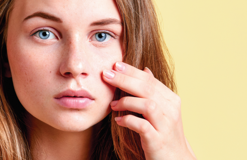 Les astuces naturelles pour lutter contre l&rsquo;acné